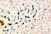 macrophages of the liver