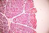 adipose-tissue-human-soft-palate-bone