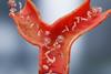 Stem-cell-therapy-sickle-cell-disease