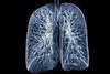 chest lung xray