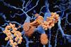 Alzheimer’s-stem-cell-therapy