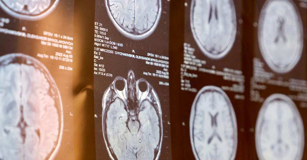 Sundance’s oral TYK2 inhibitor illustrates early promise in multiple sclerosis
