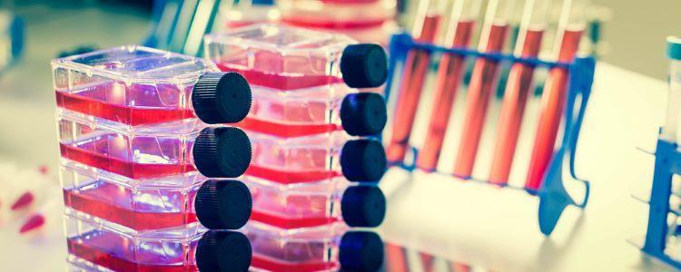 Novel PAT system could enable adaptive process control | News ...