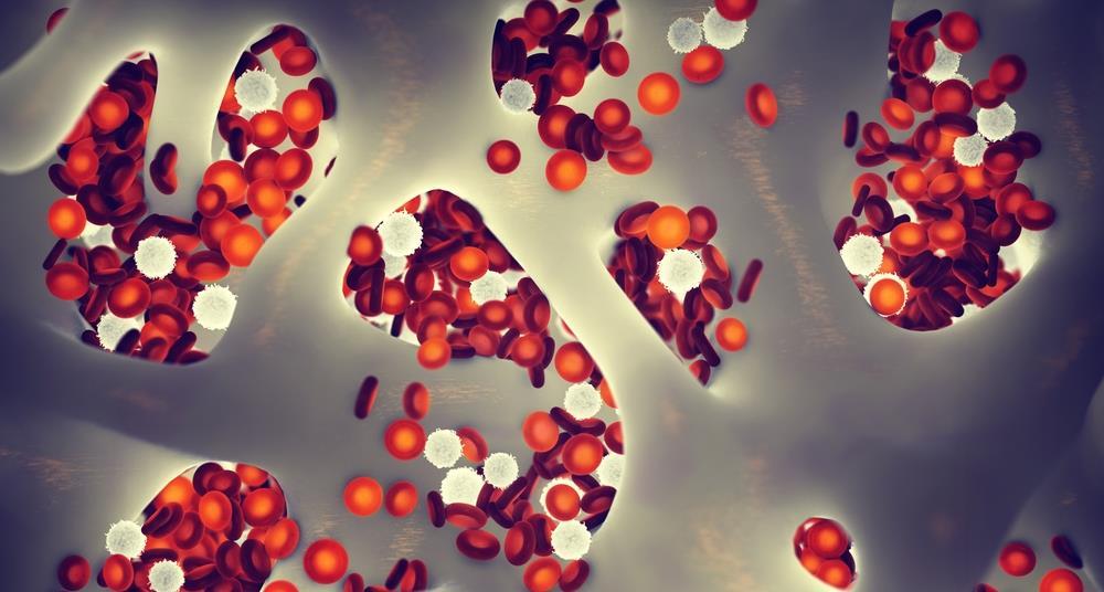 US approval of Orca’s Tregzi landmark advance for stem cell transplants