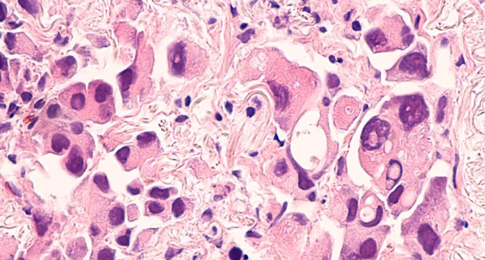 AstraZeneca licenses novel oral EGFR inhibitor for $1.5bn