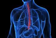 3d-rendered-medical-illustration-inflamed-esophagus