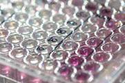 closeup-view-microwell-plate