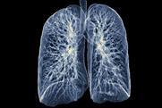 chest lung xray