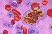 ciclosporin-cyclosporine-steroid-sparing-immunosuppressant-agent-blood