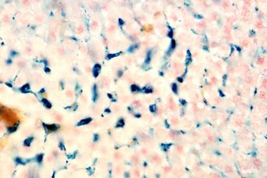 macrophages of the liver