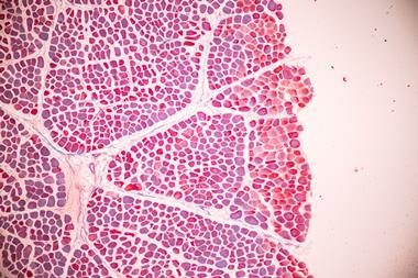 adipose-tissue-human-soft-palate-bone