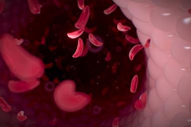 3D render sickle cell blood cells
