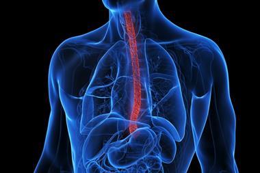 3d-rendered-medical-illustration-inflamed-esophagus