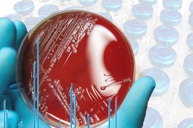 Bruker feature image