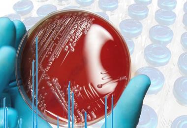 Bruker feature image