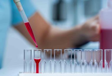 Surface-Enhanced Raman Spectroscopy (SERS): sample on substrate inside the cuvette that enhances Raman scattering signals