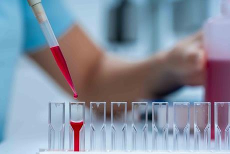 Surface-Enhanced Raman Spectroscopy (SERS): sample on substrate inside the cuvette that enhances Raman scattering signals