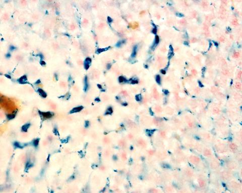 macrophages of the liver