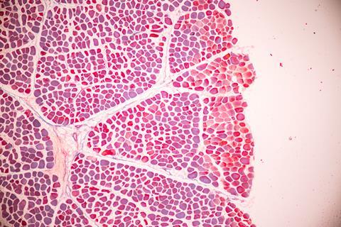adipose-tissue-human-soft-palate-bone