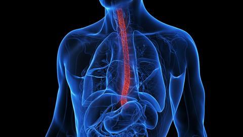 3d-rendered-medical-illustration-inflamed-esophagus