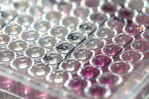 closeup-view-microwell-plate
