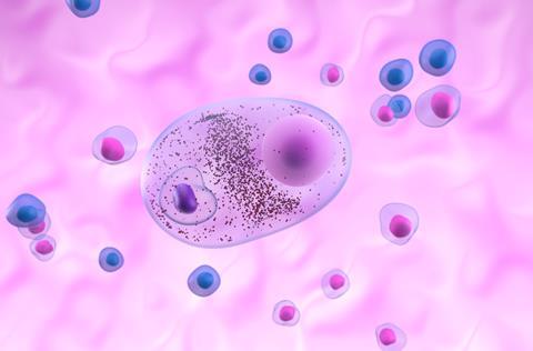 lewy bodies parkinson's