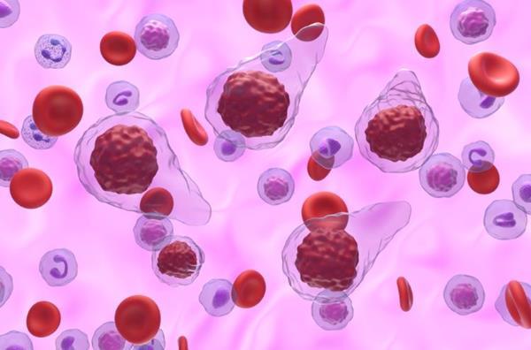 First treatment for myelofibrosis with anaemia approved | News ...